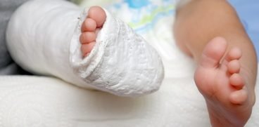 Bebelusul meu s-a nascut cu picioarele strambe! Ce e de facut?