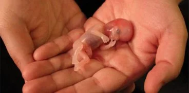 Romania, locul 1 in Europa si 2 mondial la rata de AVORTURI – raport ingrijorator | Demamici.ro