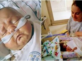 S-a nascut „fara intestin” si i s-au dat 1 % sanse sa traiasca! Dupa 209 zile in spital, un miracol s-a intamplat! Cum arata baietelul acum | Demamici.ro