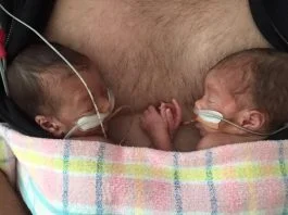 Gemeni, nascuti la 28 de saptamani, se tin de mana pe pieptul tatalui! Cata dragoste incape in inimioarele mici ale prematurilor VIDEO | Demamici.ro