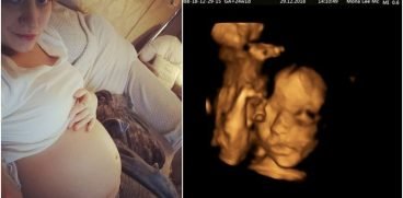 Copil nenascut, operat si pus inapoi in uterul mamei, in Marea Britanie | Demamici.ro