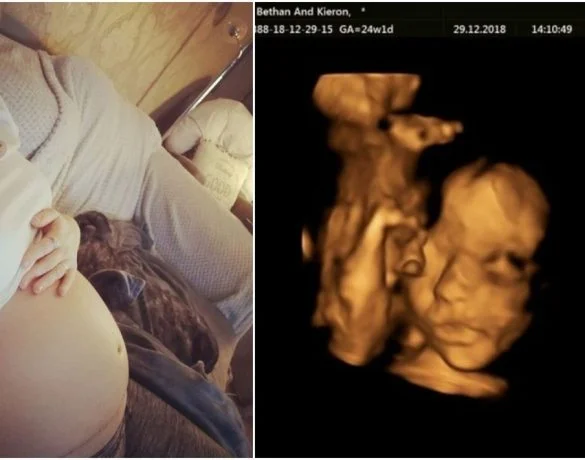 Copil nenascut, operat si pus inapoi in uterul mamei, in Marea Britanie | Demamici.ro