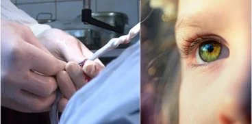 Primul transplant cu celule stem pentru tratarea autismului – Premiera in Romania | Demamici.ro