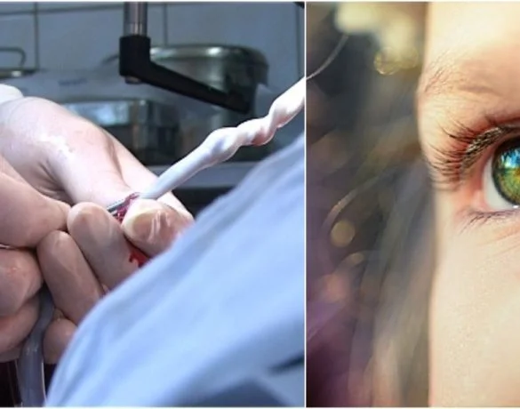 Primul transplant cu celule stem pentru tratarea autismului – Premiera in Romania | Demamici.ro