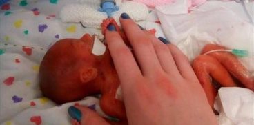 Un medic neonatolog, impresionat de cazul unei fetite avortate la 23 de saptamani: „A trait 10 ore in care am vazut-o murind incet! Am tinut-o in brate. Mama nu a dorit-o!” | Demamici.ro