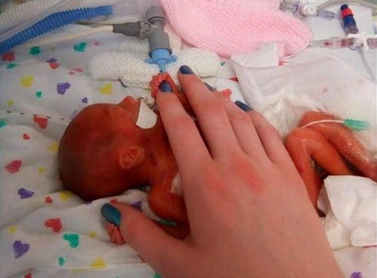 Un medic neonatolog, impresionat de cazul unei fetite avortate la 23 de saptamani: „A trait 10 ore in care am vazut-o murind incet! Am tinut-o in brate. Mama nu a dorit-o!” | Demamici.ro