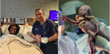 Sextupleti, nascuti pe cale naturala in mai putin de 10 minute. Femeia a avut o sarcina extrem de rara, 1 la 4,7 miliarde | Demamici.ro