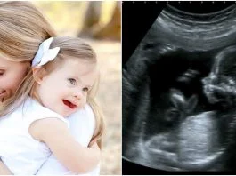 A aflat ca fetita ei se va naste cu sindromul Down inca de cand o purta in burtica. Mama a dat o lectie de viata pretioasa: „Am stiut ca te iubesc, inainte sa te cunosc!” | Demamici.ro