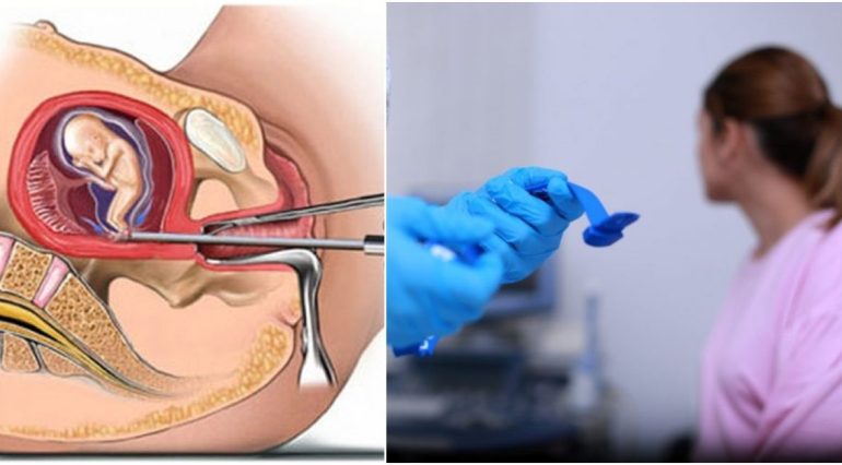 Medicii refuza sa mai faca avorturi la cerere in Postul Pastelui | Demamici.ro