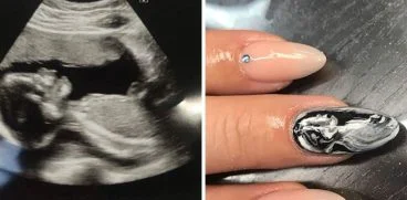 Ecografiile pictate pe unghii – ultima moda printre gravide | Demamici.ro