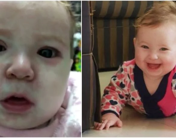 O fetita de 8 luni a ajuns in stare grava la spital dupa ce a facut rujeola | Demamici.ro