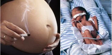 O tigara pe zi in timpul sarcinii dubleaza riscul aparitiei sindromului de moarte subita a sugarului | Demamici.ro