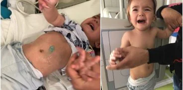 Chinul prin care a trecut fetita dupa ce asistenta i-a rupt un bat in nasuc. Ce au descoperit medicii la radiografie | Demamici.ro