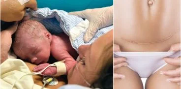 Recuperarea dupa cezariana. Ce as fi vrut sa stiu inainte de operatie| Demamici.ro