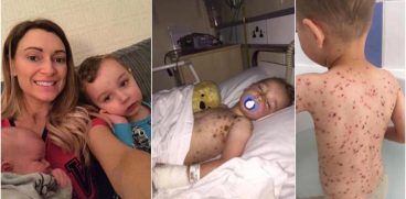 De ce NU trebuie sa-i dai ibuprofen copilului cu varsat de vant! Academia de Pediatrie avertizeaza | Demamici.ro