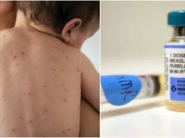 Amenzi de 2500 de euro pentru parintii care nu-si vaccineaza copiii impotriva rujeolei | Demamici.ro