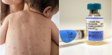 Amenzi de 2500 de euro pentru parintii care nu-si vaccineaza copiii impotriva rujeolei | Demamici.ro