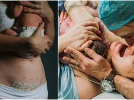 Doctorul Mihai Craiu, despre diferentele dintre copiii nascuti prin cezariana si cei nascuti natural | Demamici.ro