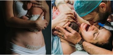 Doctorul Mihai Craiu, despre diferentele dintre copiii nascuti prin cezariana si cei nascuti natural | Demamici.ro