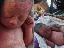 Fetita nou-nascuta, abandonata pe un camp. Micuta a fost gasit plina de furnici, acoperita de muscaturi de tantari | Demamici.ro