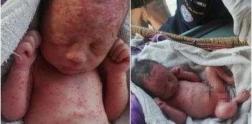 Fetita nou-nascuta, abandonata pe un camp. Micuta a fost gasit plina de furnici, acoperita de muscaturi de tantari | Demamici.ro