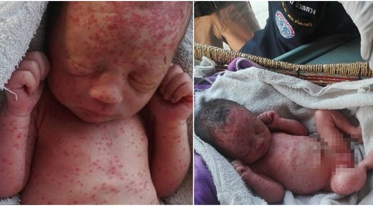 Fetita nou-nascuta, abandonata pe un camp. Micuta a fost gasit plina de furnici, acoperita de muscaturi de tantari | Demamici.ro