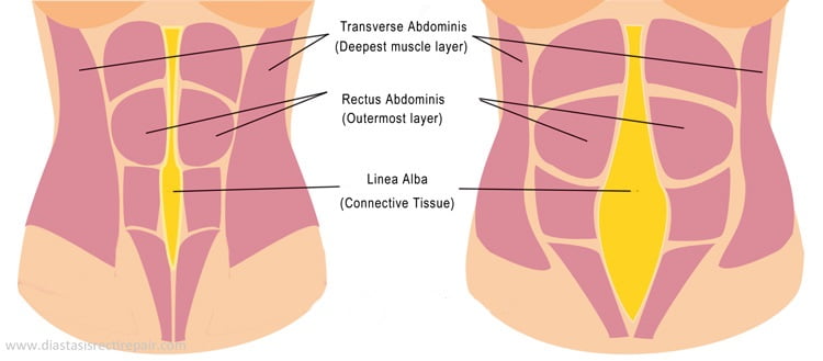 "Am nascut, dar burta mea arata de parca as fi insarcinata in 3,4 luni!" Ce trebuie sa stii despre diastaza abdominala| Demamici.ro