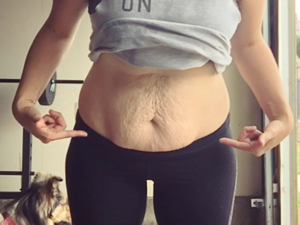 "Am nascut, dar burta mea arata de parca as fi insarcinata in 3,4 luni!" Ce trebuie sa stii despre diastaza abdominala| Demamici.ro