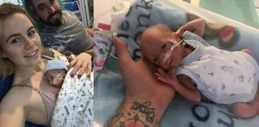 La 27 de saptamani a invins boala rara care i-a omorat fratele geaman in burta mamei. Povestea micutului care a sfidat legile naturii | Demamici.ro