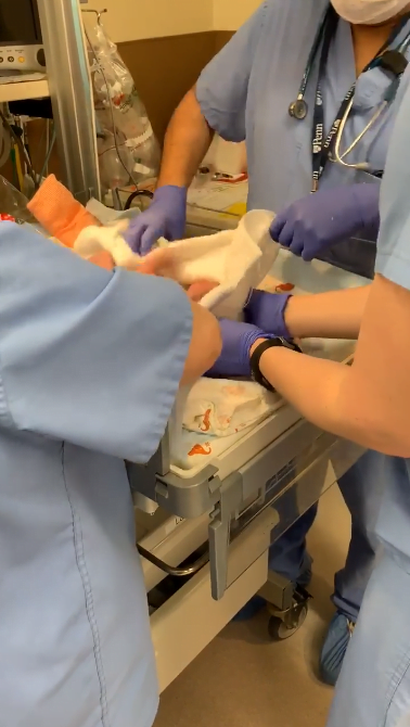 Doctorii i-au scapat fetita in cap, la nastere. Micuta avea doar 1474 g. Sotul a filmat momentul VIDEO | Demamici.ro