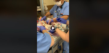 Doctorii i-au scapat fetita in cap, la nastere. Micuta avea doar 1474 g. Sotul a filmat momentul VIDEO | Demamici.ro