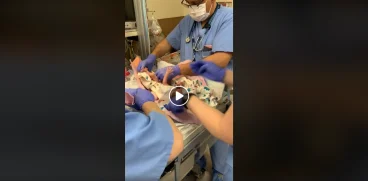 Doctorii i-au scapat fetita in cap, la nastere. Micuta avea doar 1474 g. Sotul a filmat momentul VIDEO | Demamici.ro