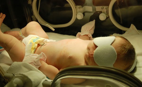 Icterul la nou-nascuti. Cand exista motive de ingrijorare? | Demamici.ro