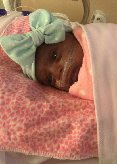 Cel mai mic bebelus din lume s-a nascut cu 245 de grame. La 5 luni, fetita a fost externata din spital. Cum arata VIDEO | Demamici.ro