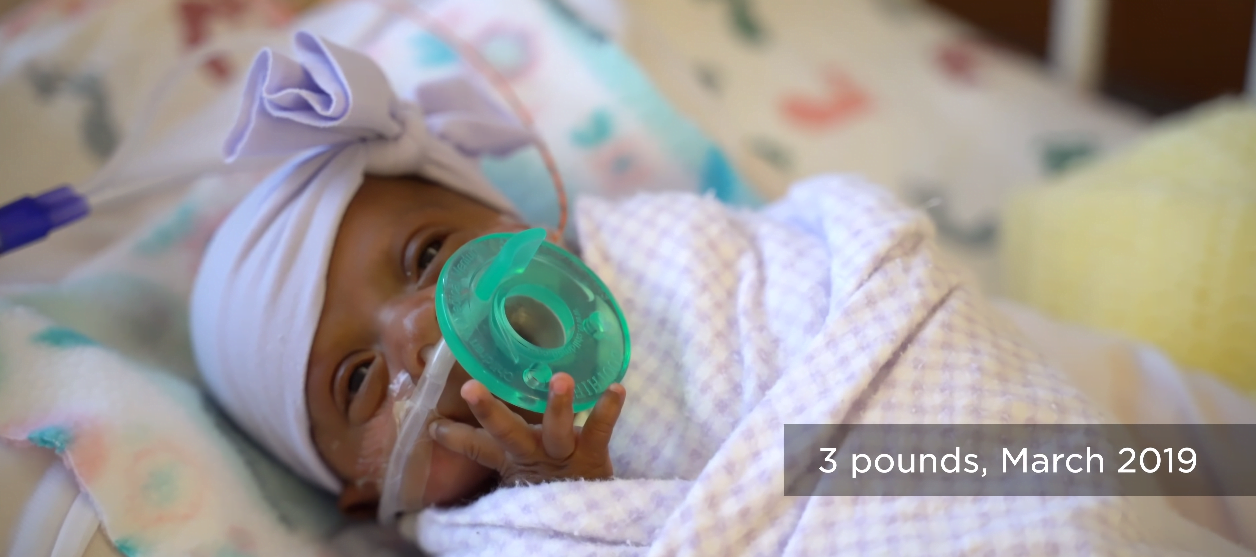 Cel mai mic bebelus din lume s-a nascut cu 245 de grame. La 5 luni, fetita a fost externata din spital. Cum arata VIDEO | Demamici.ro