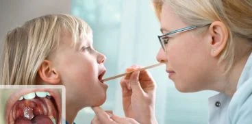 Faringita – rosul in gat – principala cauza de prescriptie inutila de antibiotice la copii | Demamici.ro