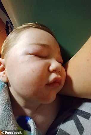 Un baietel de 2 ani a stat in coma o saptamana dupa ce a fost muscat de o capusa | Demamici.ro