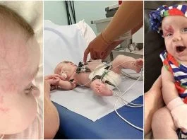 Medicii au trimis-o cu fetita nou-nascuta acasa, spunandu-i ca are doar un semn din nastere. Un strain de pe Facebook a descoperit adevarul | Demamici.ro
