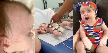 Medicii au trimis-o cu fetita nou-nascuta acasa, spunandu-i ca are doar un semn din nastere. Un strain de pe Facebook a descoperit adevarul | Demamici.ro