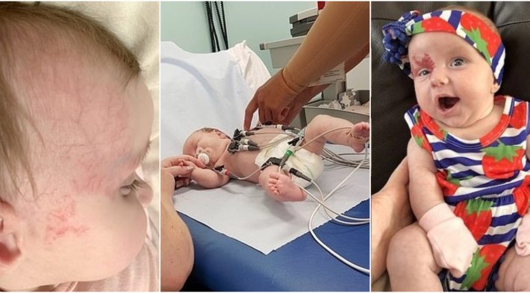 Medicii au trimis-o cu fetita nou-nascuta acasa, spunandu-i ca are doar un semn din nastere. Un strain de pe Facebook a descoperit adevarul | Demamici.ro