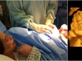 Legile stricte impotriva avortului din SUA „au obligat o femeie sa dea nastere unui copil fara craniu”! Marturia unui doctor | Demamici.ro