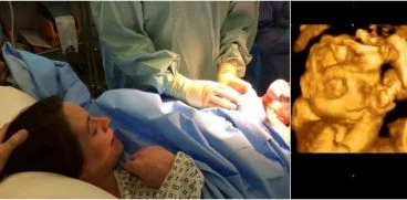 Legile stricte impotriva avortului din SUA „au obligat o femeie sa dea nastere unui copil fara craniu”! Marturia unui doctor | Demamici.ro