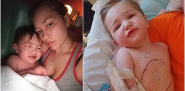 Un baietel de 2 ani a stat in coma o saptamana dupa ce a fost muscat de o capusa | Demamici.ro