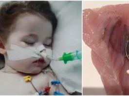 Experiment! Ce se intampla in corpul copilului care inghite o baterie | Demamici.ro