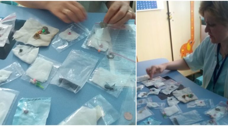 Cele mai ciudate obiecte gasite in stomacul copiilor ajunsi la spital: ace, monede, baterii, medalioane | Demamici.ro
