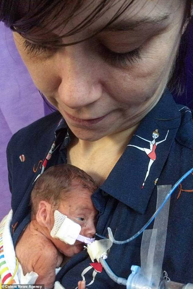 Fetita care s-a nascut prematur la doar 23 de saptamani a implinit doi ani