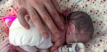 S-a nascut la 23 de saptamani de sarcina si era cat palma mamei. Acum are 2 ani | Demamici.ro