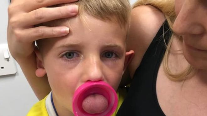 Un baietel, la un pas de moarte dupa ce limba i-a ramas blocata in sticla de apa | Demamici.ro