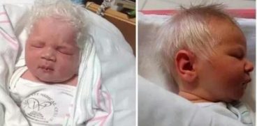 Un bebelus s-a nascut cu parul in totalitate alb. Cum explica medicii asta | Demamici.ro