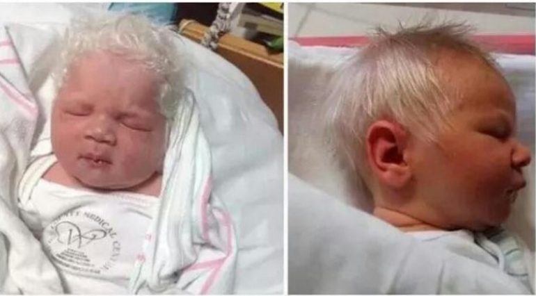 Acesta este bebelusul născut cu părul in totaliate al